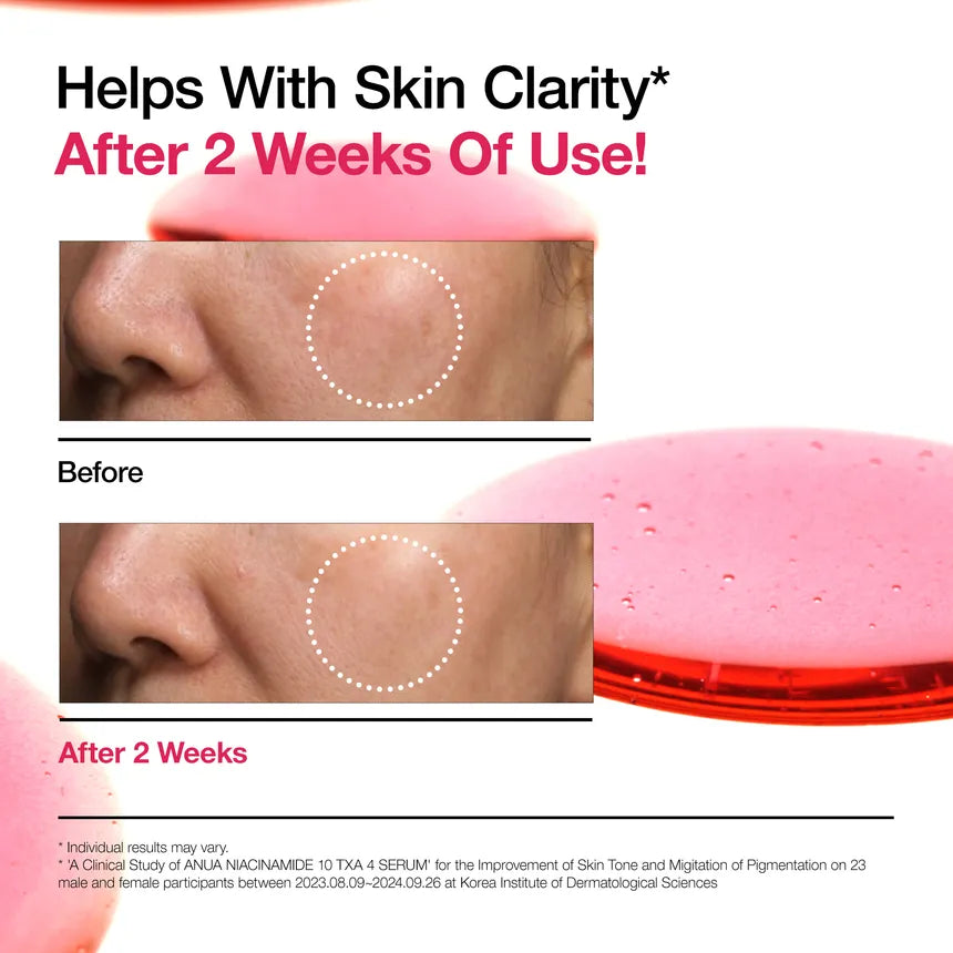 Anua - Sérum con Niacinamida10% + TXA 4% 30ml